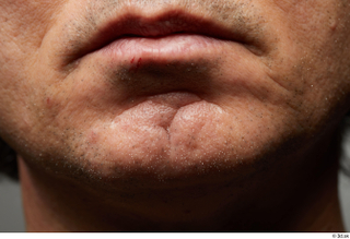 HD Face Skin Benito Romero chin face lips mouth scar…